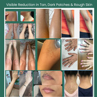 MIracle Skin Fairness Oil™